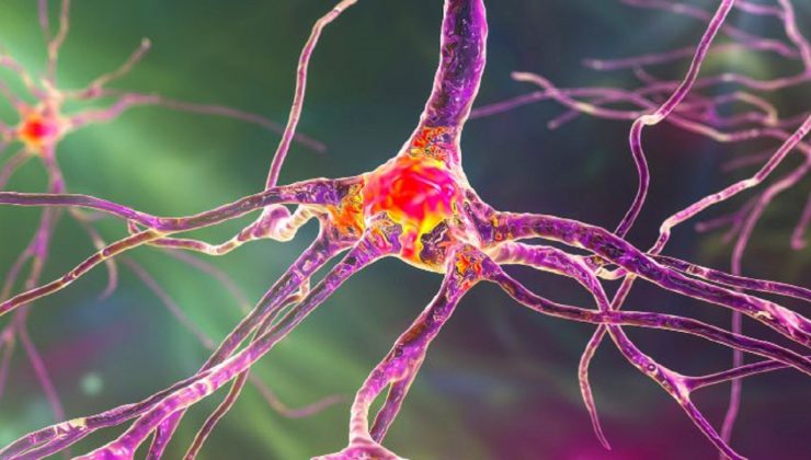 Genetiğiyle oynanan domuz karaciğeri bir insana nakil edildi! Sonuç umut verici!